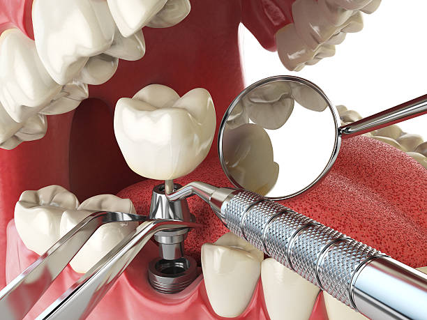 Best Tooth Infection Emergency Dentist  in Seven Hills, OH