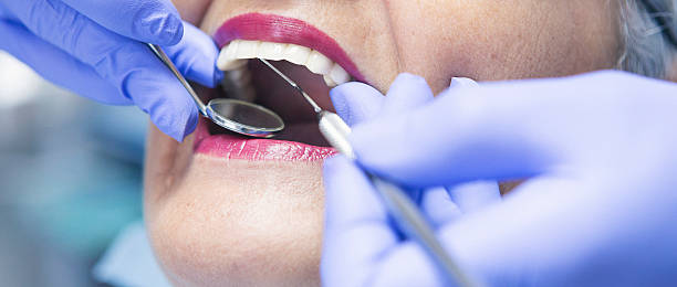 Best Dentist for Tooth Abscess  in Seven Hills, OH